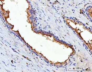VPAC2 Antibody / VIPR2