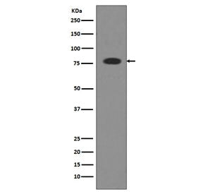 Western blot testing of human serum lysate with Transferrin antibody. Predicted molecular weight ~77