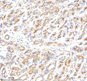 Immunohistochemical staining of CLTB using anti-CLTB antibody. CLTB was detected in a paraffin-embed