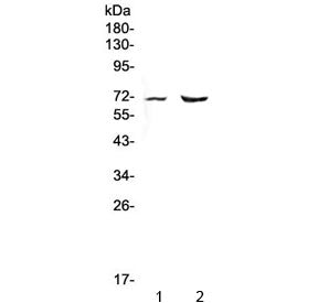 Western blot testing of 1) rat heart and 2) mouse heart lysate with PMEL17 antibody at 0.5ug/ml. Pre