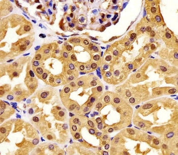IHC testing of FFPE human kidney tissue with PGK1 antibody. HIER: steam section in pH6 citrate buffe