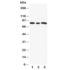 Western blot testing of Gli3 antibody and Lane 1: rat testis; 2: human A549; 3: (h) SW620 cell lysat