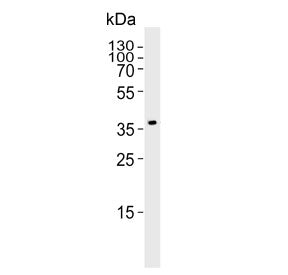 Pdgfd Antibody / Platelet-derived growth factor D
