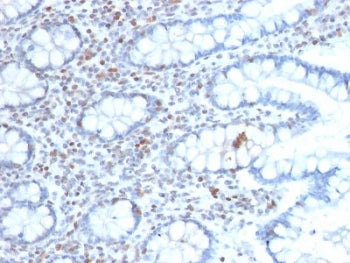 BMI1 Antibody