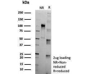 SDS-PAGE analysis of purified, BSA-free recombinant Apolipoprotein J antibody (clone CLU/9192R) as c