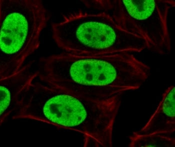 Immunofluorescent staining of paraformaldehyde fixed human HeLa cells with Ku70 + Ku80 antibody (clo