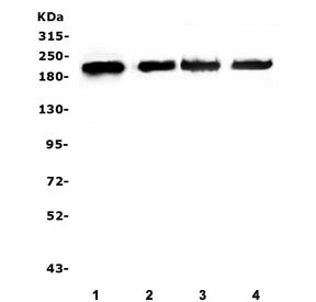 Western blot testing of human 1) SGC-7901, 2) U-87 MG, 3) HEK293 and 4) PC-3 cell lysate with ZEB1 a
