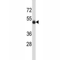 CD43 antibody western blot analysis in MDA-MB435 lysate. Predicted molecular weight 45-115 kDa depen