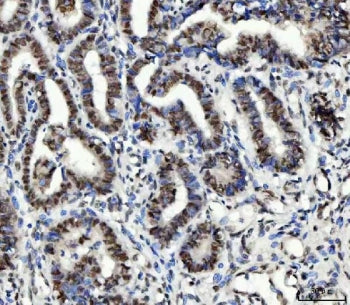 UBE2N Antibody / Ubc13
