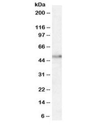 Western blot testing of human hippocampus lysate with Orexin Receptor 2 antibody at 1.5ug/ml. Predic