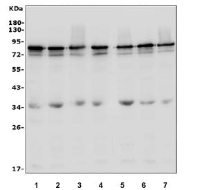 LYRIC Antibody (Metadherin)