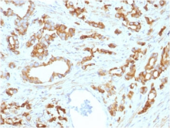 IHC testing of FFPE human prostate tissue with Aurora B antibody (clone AURKB/1593). HIER: boil tiss