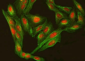 Regulatory factor X 3 Antibody / RFX3