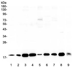 Western blot testing of 1) rat brain, 2) rat heart, 3) rat liver, 4) rat kidney, 5) human HeLa, 6) h