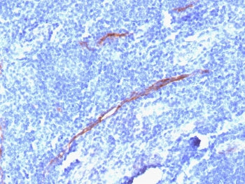 IHC testing of FFPE human tonsil with recombinant CD34 antibody (clone HPCA1/1806R). Required HIER: 