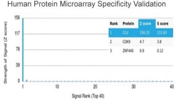 Analysis of HuProt(TM) microarray containing more than 19,000 full-length human proteins using Clust