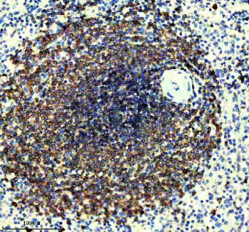 IHC staining of FFPE human spleen tissue with CD22 antibody, HRP-secondary and DAB substrate. HIER: 