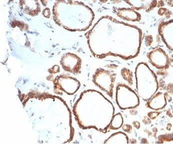 IHC staining of FFPE human thyroid tissue with HSP90AB1 antibody (clone HSP90AB1/4970). HIER: boil t