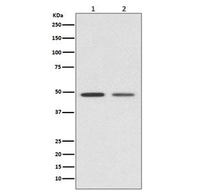 Western blot testing of 1) human HeLa and 2) mouse kidney lysate with Vitamin D Receptor antibody. P
