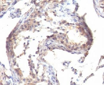 TGF alpha Antibody