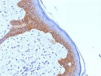 IHC testing of FFPE human skin with Desmoglein 3 antibody (clone 5G11). Required HIER: boil tissue s