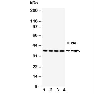 Western blot testing of Caspase-12 antibody; Lane 1: PANC; 2: SMMC-7721; 3: A549; 4: HeLa. Predicted molecular weight ~50/36~42kDa (pro/active).