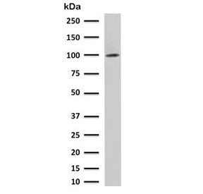 Western blot testing of human LNCaP cell lysate with FOLH1 antibody. Predicted molecular weight ~100