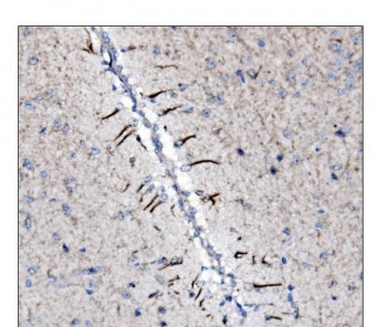 IHC staining of FFPE mouse brain tissue with Neurofilament-66 antibody. HIER: boil tissue sections i