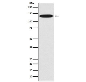Western blot testing of human A431 cell lysate with CD29 antibody. Expected molecular weight: 88~150