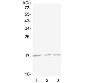 Western blot testing of 1) mouse spleen, 2) mouse kidney and 3) rat kidney lysate with Lymphotactin 