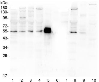 MMP13 Antibody / Collagenase 3