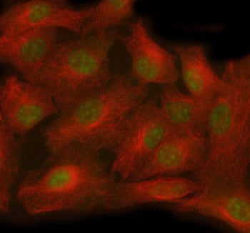 Immunofluorescent staining of TTC36 using anti-TTC36 antibody (green) and anti-Beta Tubulin antibody