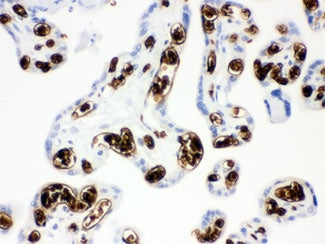 Band 3 Antibody / SLC4A1