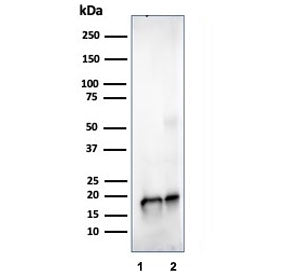 SOD1 Antibody / Superoxide Dismutase 1