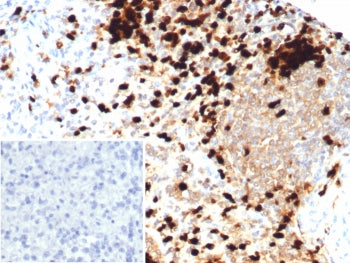 IHC staining of FFPE human spleen tissue with S100A9 antibody (clone S100A9/7550). Inset: PBS used i