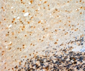 IHC testing of FFPE human cerebellum with CYP26B1 antibody at 4ug/ml. HIER: steamed with pH9 Tris/EDTA buffer, HRP-staining.