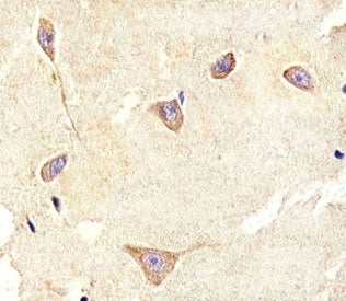 IHC analysis of FFPE human brain section using TrkC antibody; Ab was diluted at 1:100.