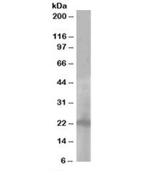 Western blot testing of A431 lysate with PALLID antibody at 1ug/ml. Predicted molecular weight: ~20k