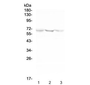 Western blot testing of human 1) U-87 MG, 2) HeLa and 3) HepG2 cell lysate with NOX2 antibody at 0.5