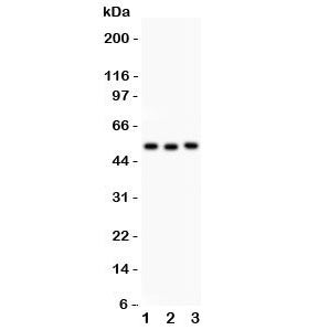 Western blot testing of Factor VII antbody and human Lane 1: SMMC-7721; 2: Jurkat; 3: Raji lysate; P