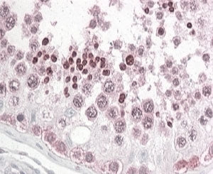 PATJ Antibody