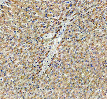 Immunohistochemical staining of CYP26B1 using anti-CYP26B1 antibody. CYP26B1 was detected in a paraf