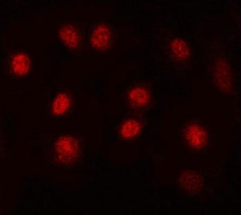 Immunofluorescent staining of FFPE human A549 cells with MAX antibody (red). HIER: steam section in 