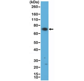 Western blot testing of human Jurkat cell lysate with recombinant ZAP70 antibody at 1:500 dilution. 