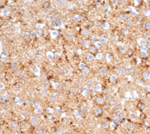 IHC staining of FFPE human brain tissue with recombinant SYP antibody (clone rSYP/6856). HIER: boil 