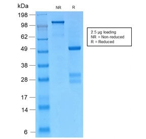 Gamma Catenin Antibody / Plakoglobin