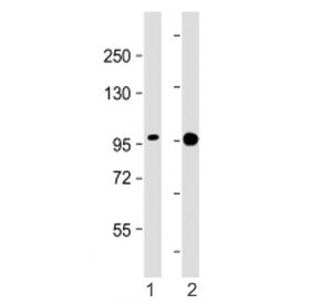 Western blot testing of SSH3 antibody at 1:2000: Lane 1) human A431 and 2) ZR-75-1 cell lysate. Pred