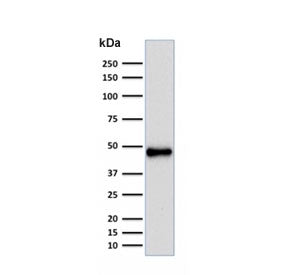Western blot testing of human Raji cell lysate with recombinant PAX5 antibody (clone rPAX5/2060). Ex