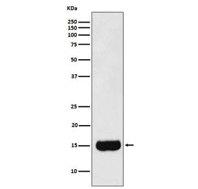 Western blot testing of human prostate cancer lysate with MSMB antibody. Predicted molecular weight 