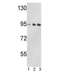 Western blot analysis of VCP antibody and 1) Jurkat, 2) 293, and 3) MDA-MB231 lysate. Predicted/obse